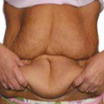 Am slabit 5 kg, dar oare merita?