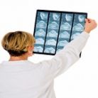 Romania, loc fruntas la accidente cardiovasculare