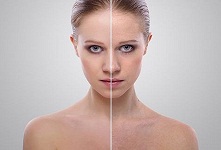5 metode eficiente care inchid porii dilatati