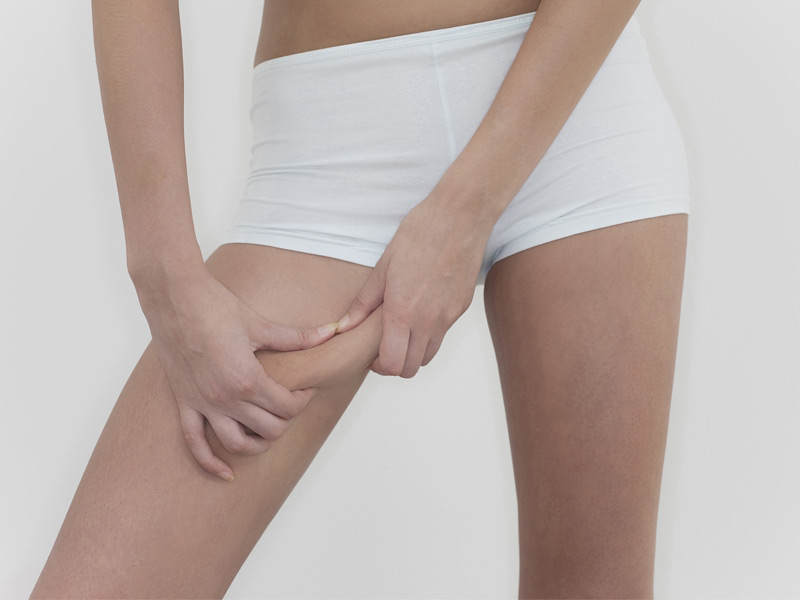7 solutii prin care poti arde celulita cu ajutorul alimentatiei