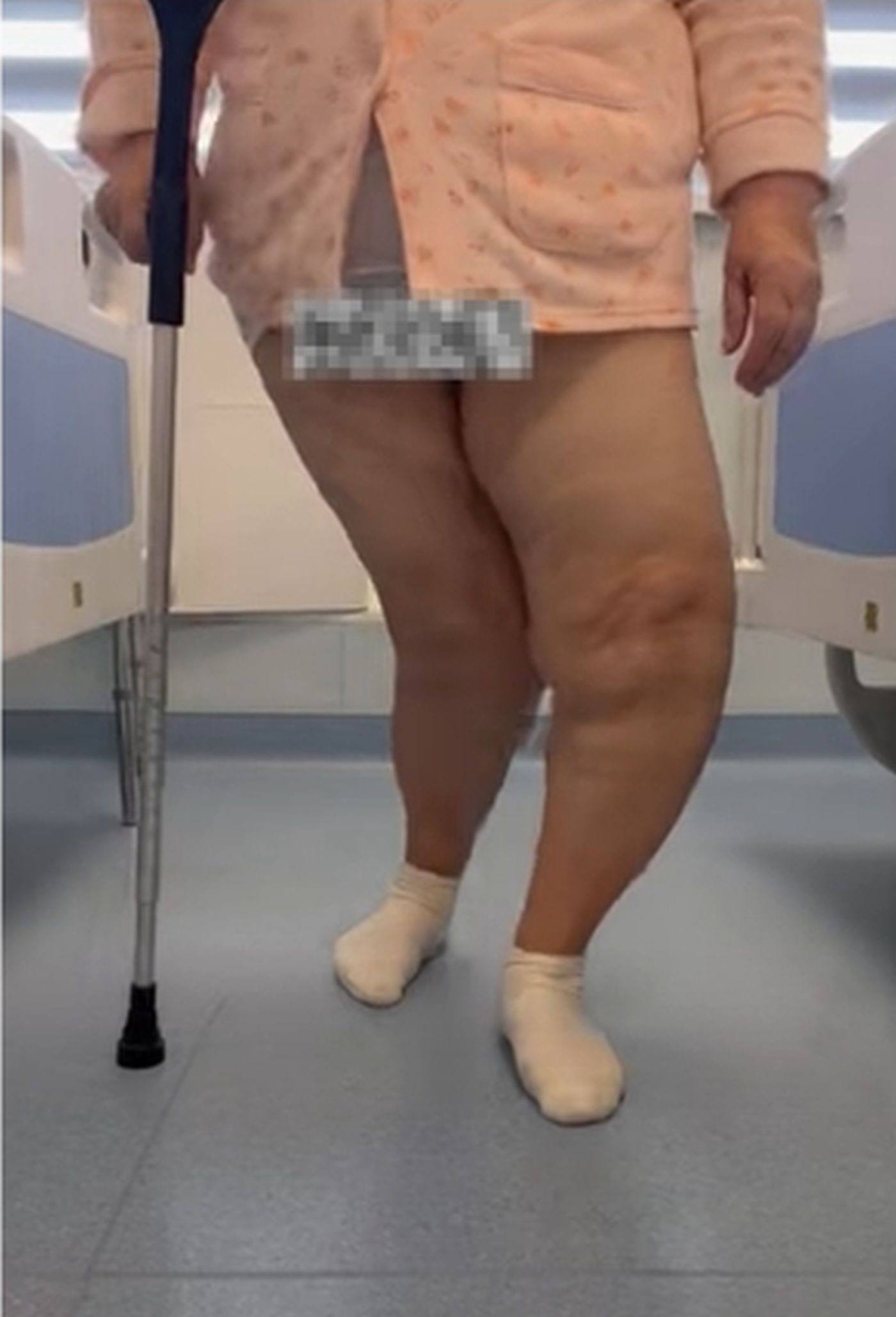 Medicii au operat cu succes un singur genunchi. sursa foto capturi Youtube