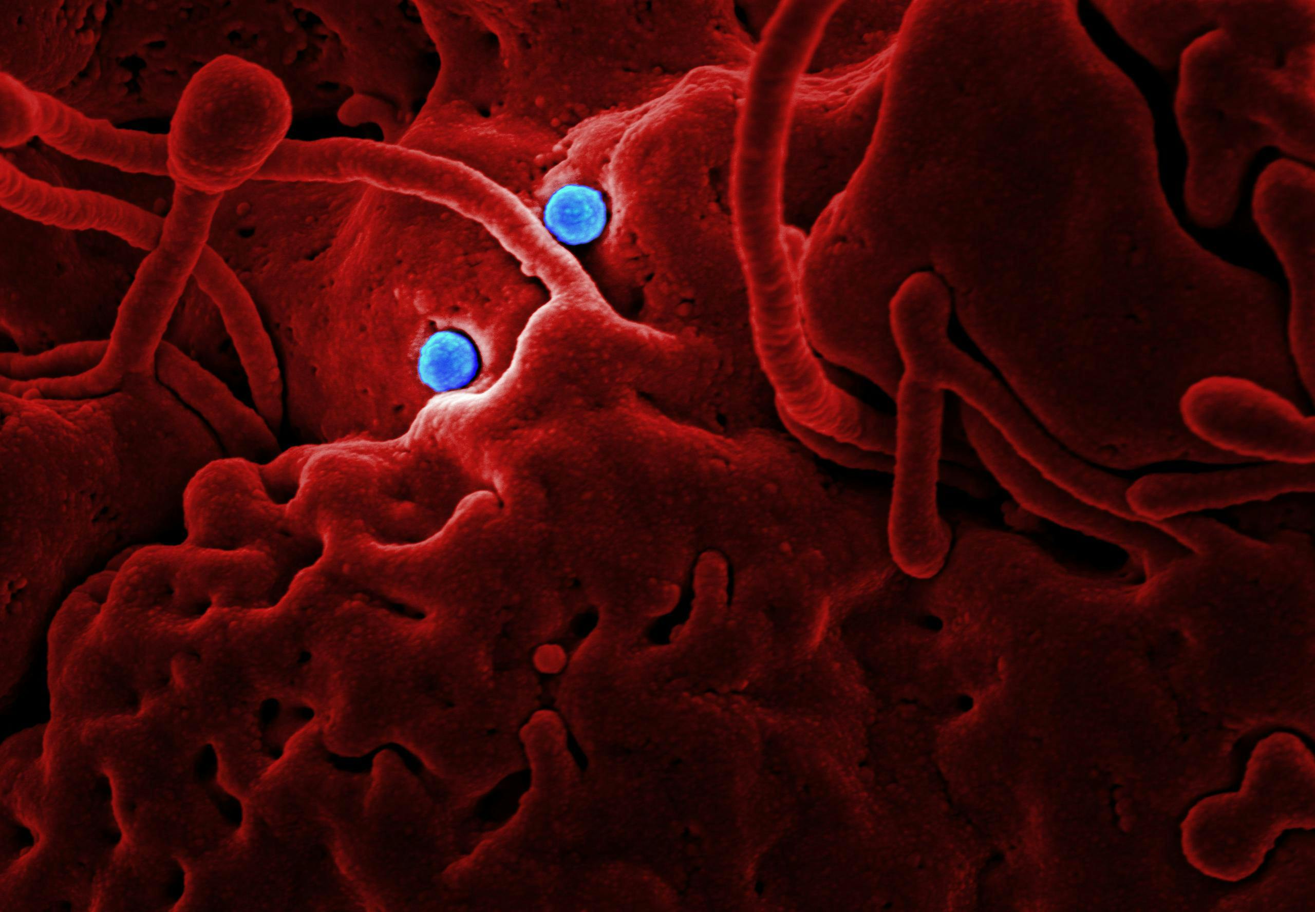 Unele bacterii pot fi foarte periculoase. sursa foto pexels.com