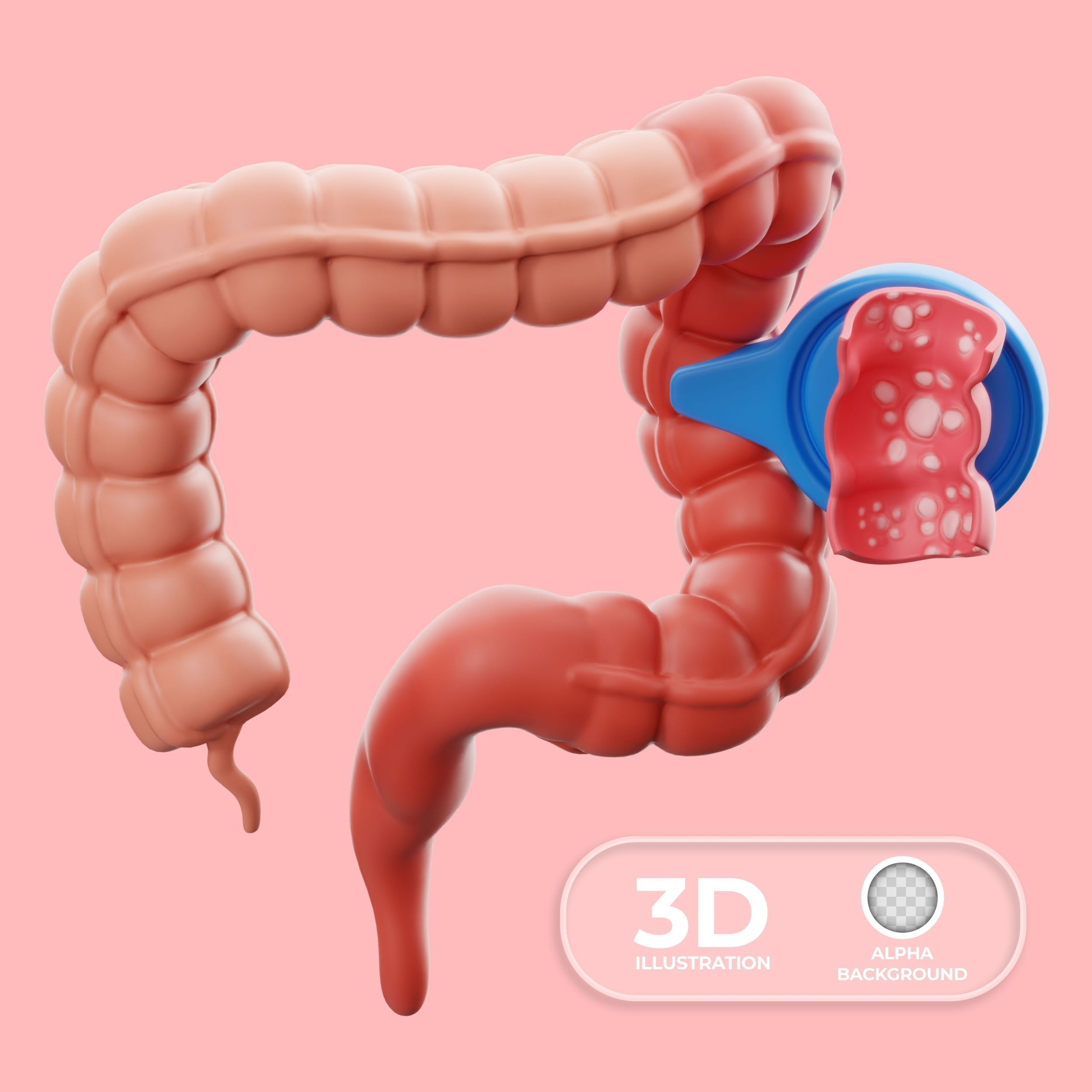 Pacientă cu cancer colorectal în stadiu terminal, vindecată. sursa foto freepik.com