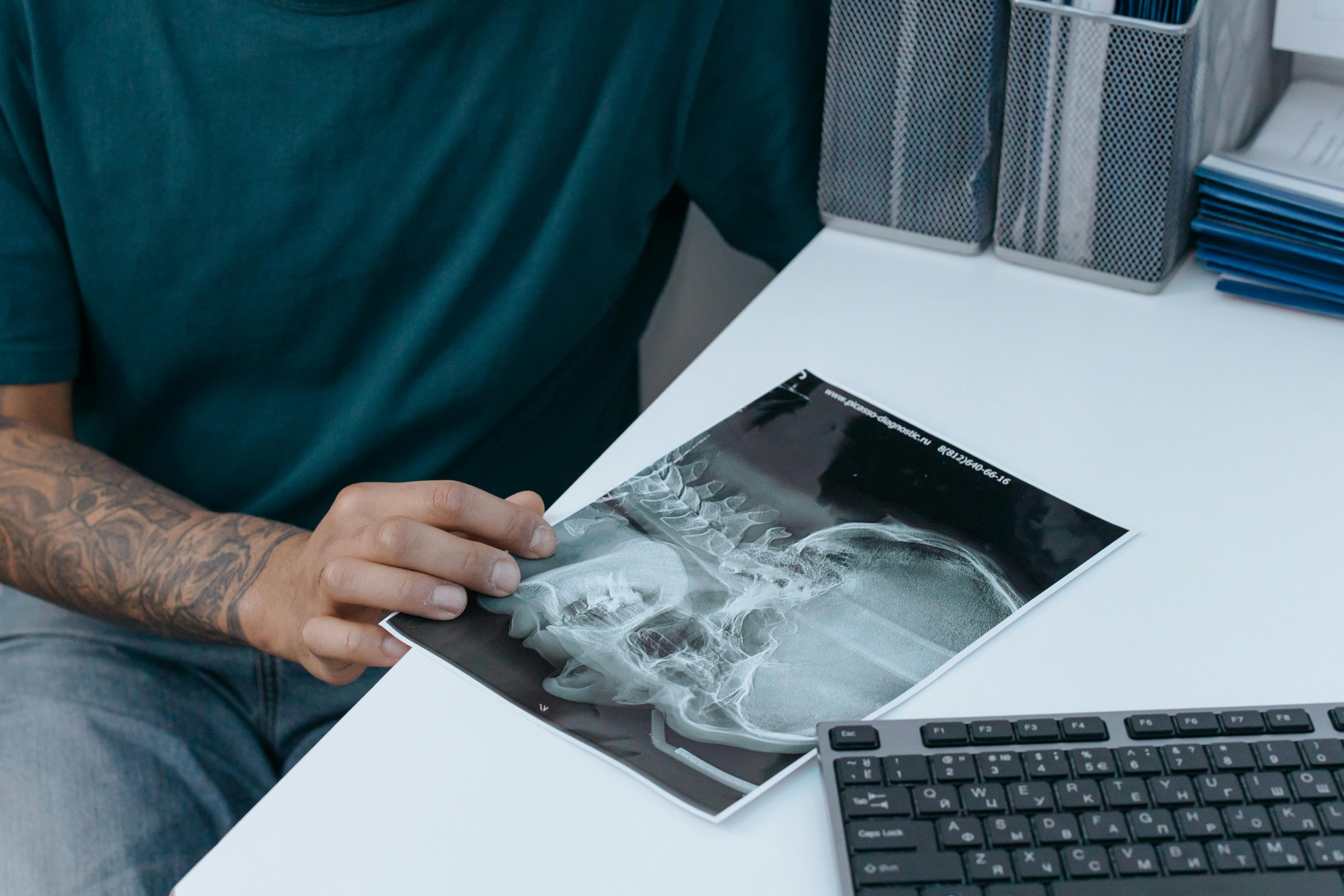 Spondiloza cervicală este dureroasă. sursa foto pexels.com
