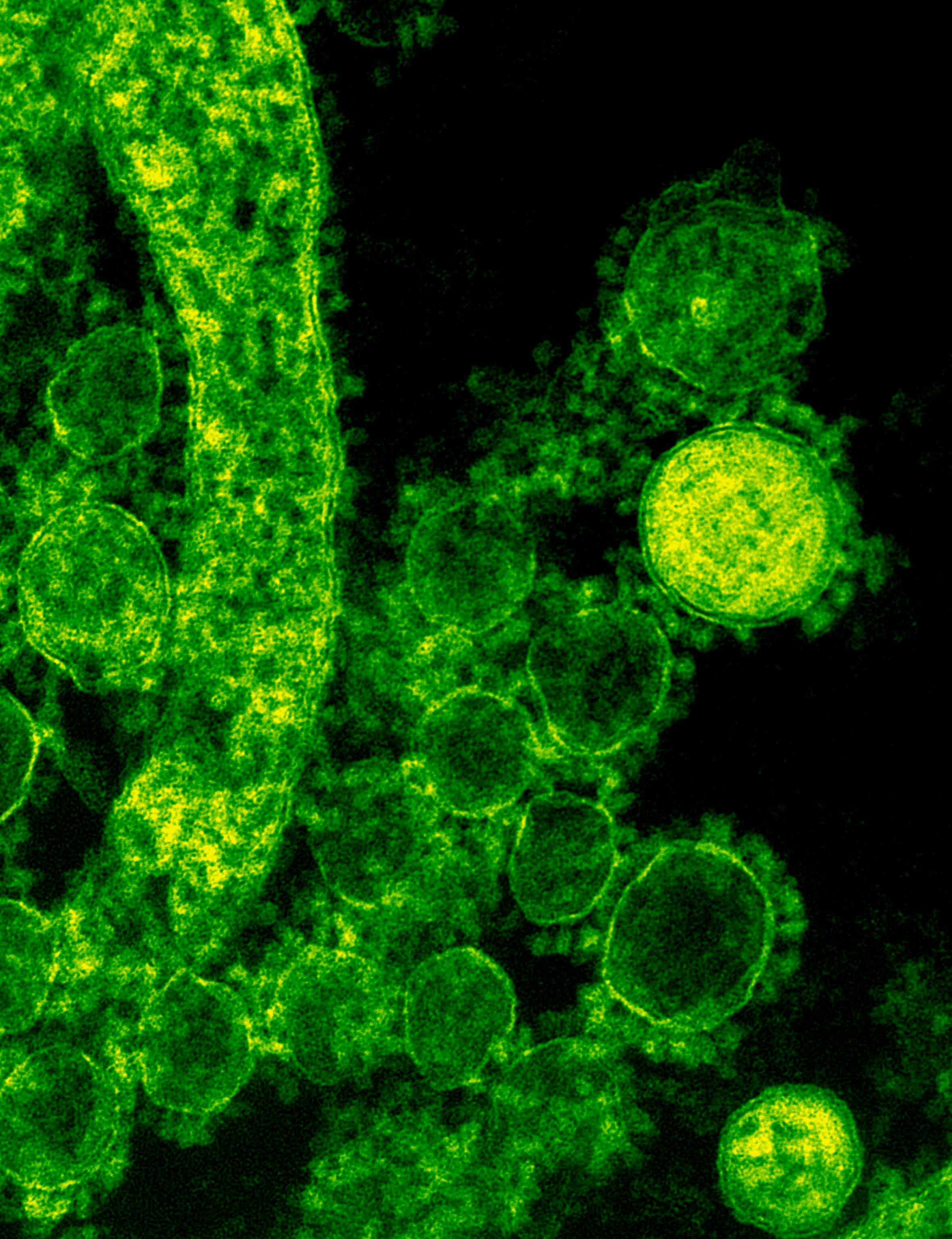 Cercetătorii vor scoate pe piață noi probiotice cu această bacterie. sursa foto pexels.com