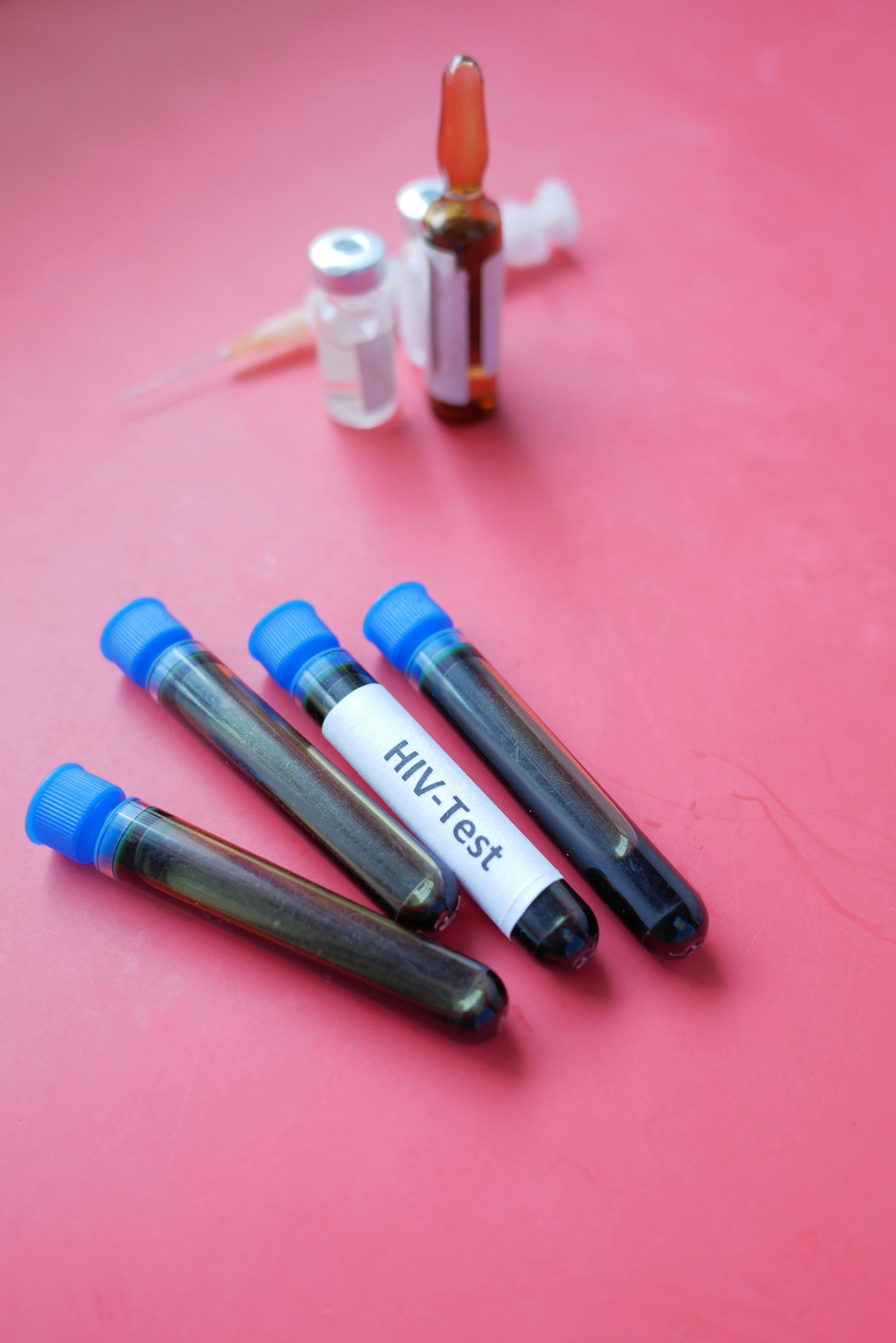 HIV este o boală des întâlnită în țările sărace. sursa foto pexels.com