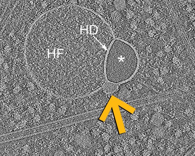 Descoperirea hemifuzomului ar putea aduce noi perspective asupra unor boli. sursa foto Tavakoli et al., Nat. Commun., 2025