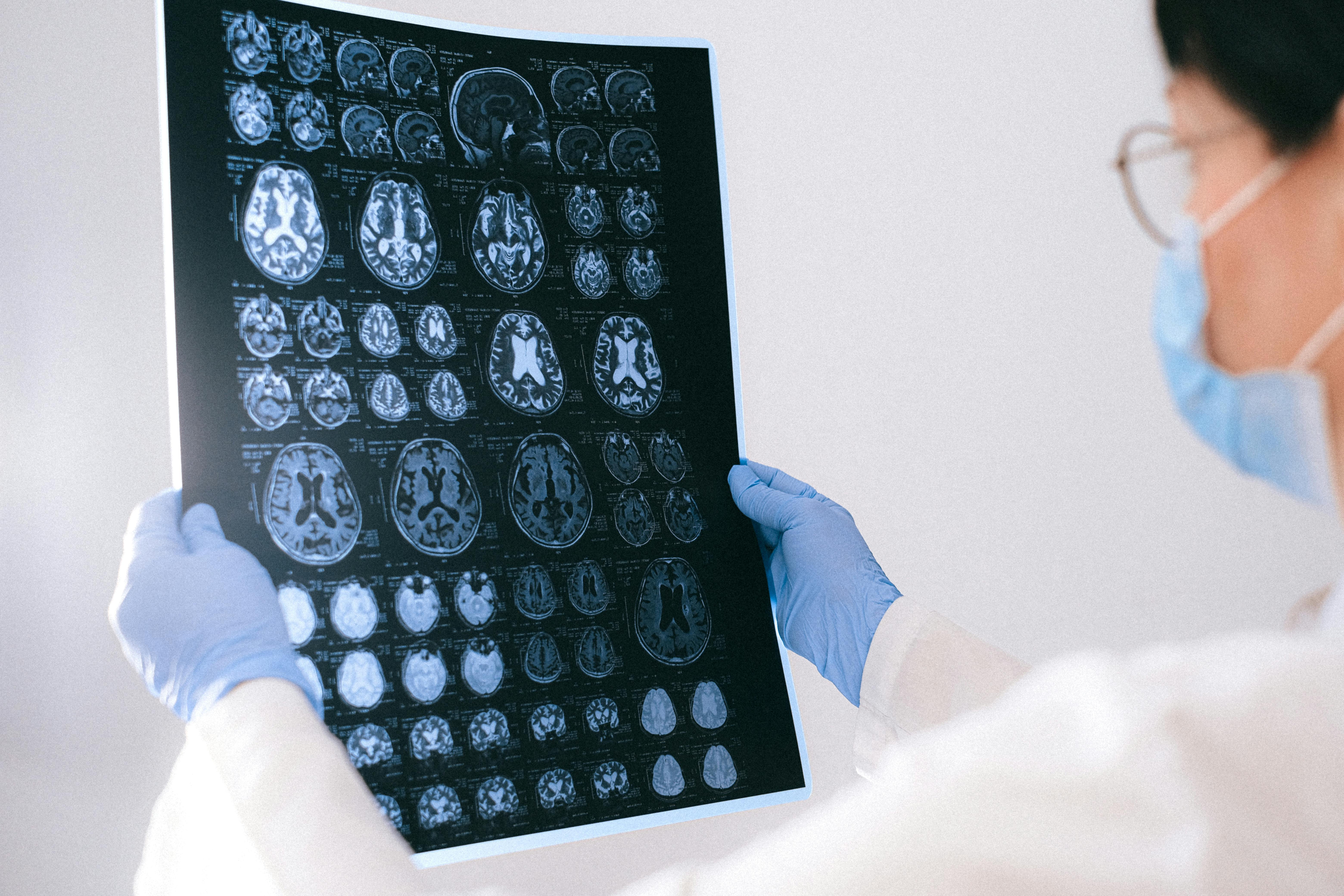 Schimbările financiare ne pot da semne de declin cognitiv. sursa foto pexels.com