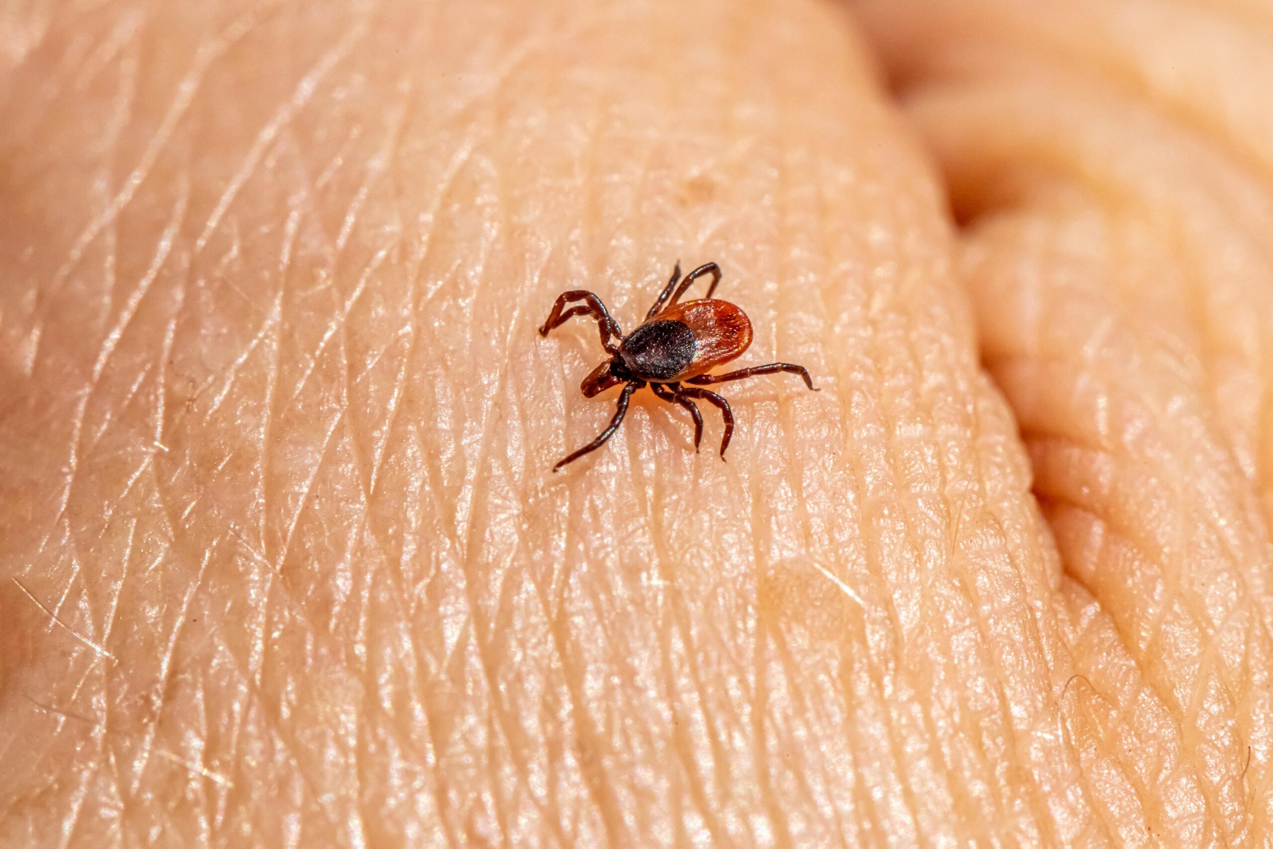 1.500 de cazuri de boala Lyme, într-un an în Marea Britanie. Atenție, români!