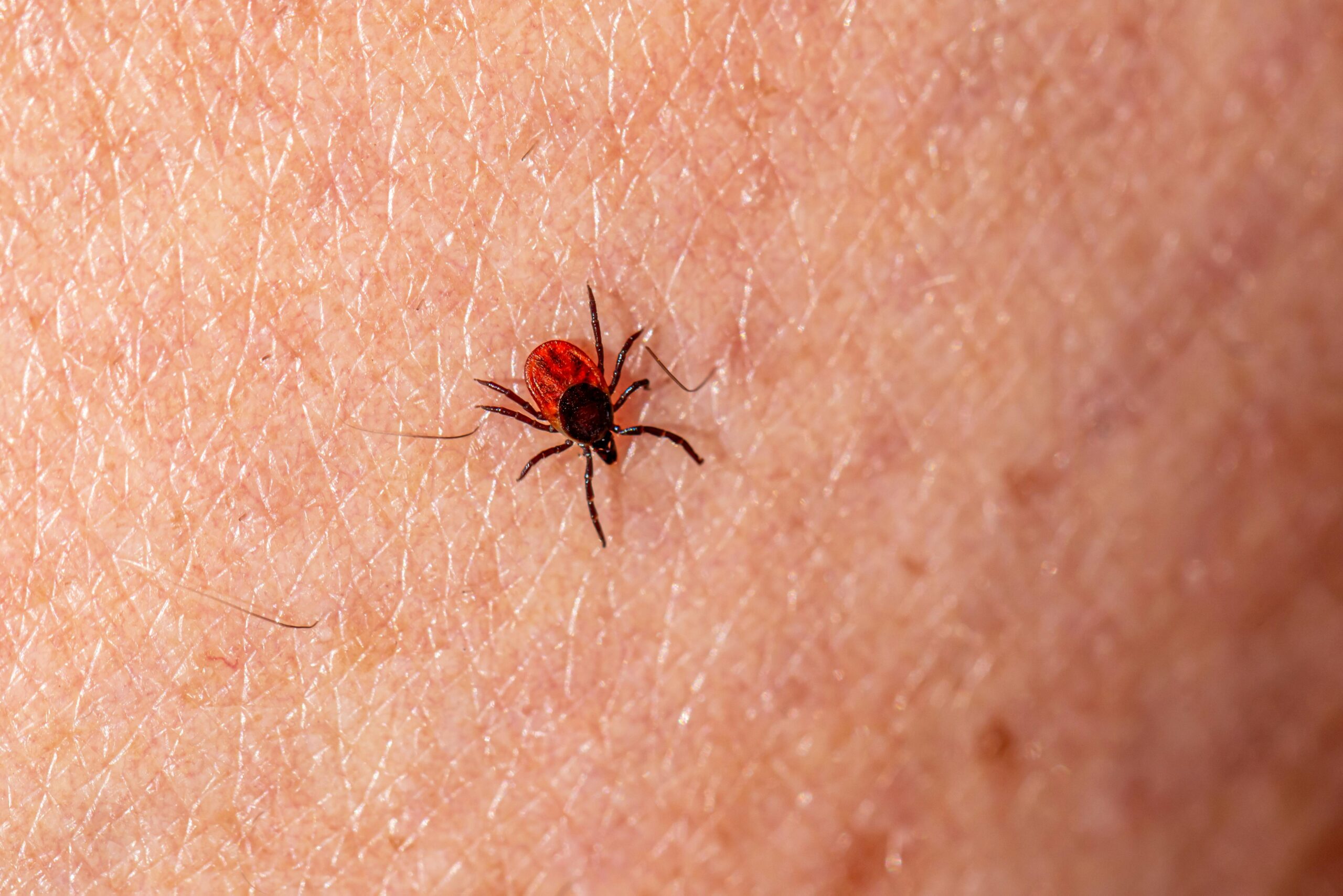 4 semne timpurii ale bolii Lyme care sunt cele mai importante. sursa foto pexels.com