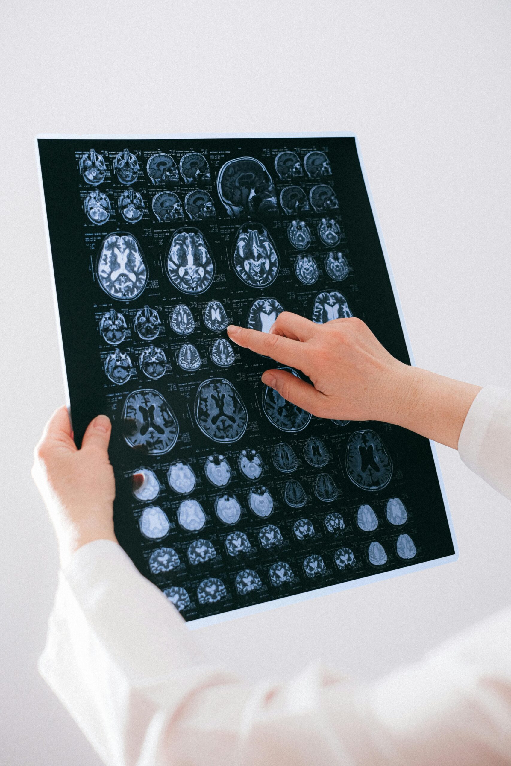 Două tipuri de celule din creier — neuronii și microglia — suferă modificări la persoanele cu depresie. sursa foto pexels.com