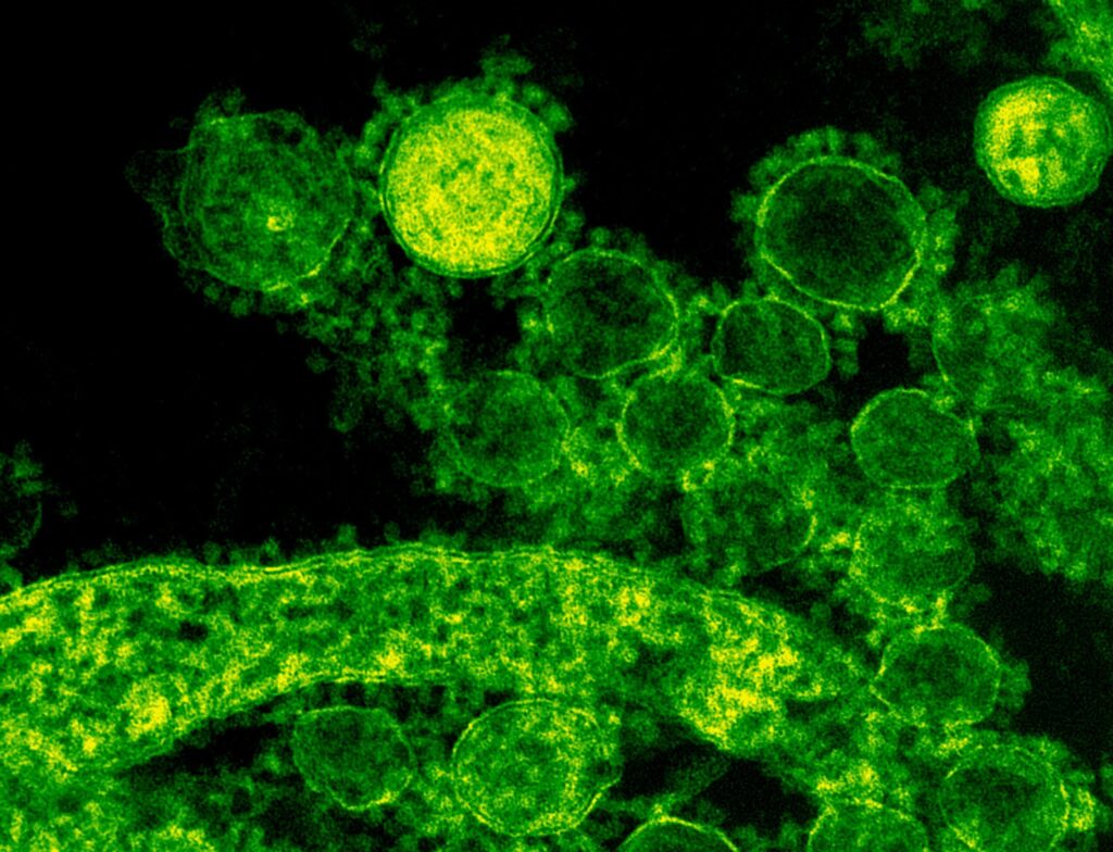 Cazurile de norovirus cresc în SUA. foto pexels.com
