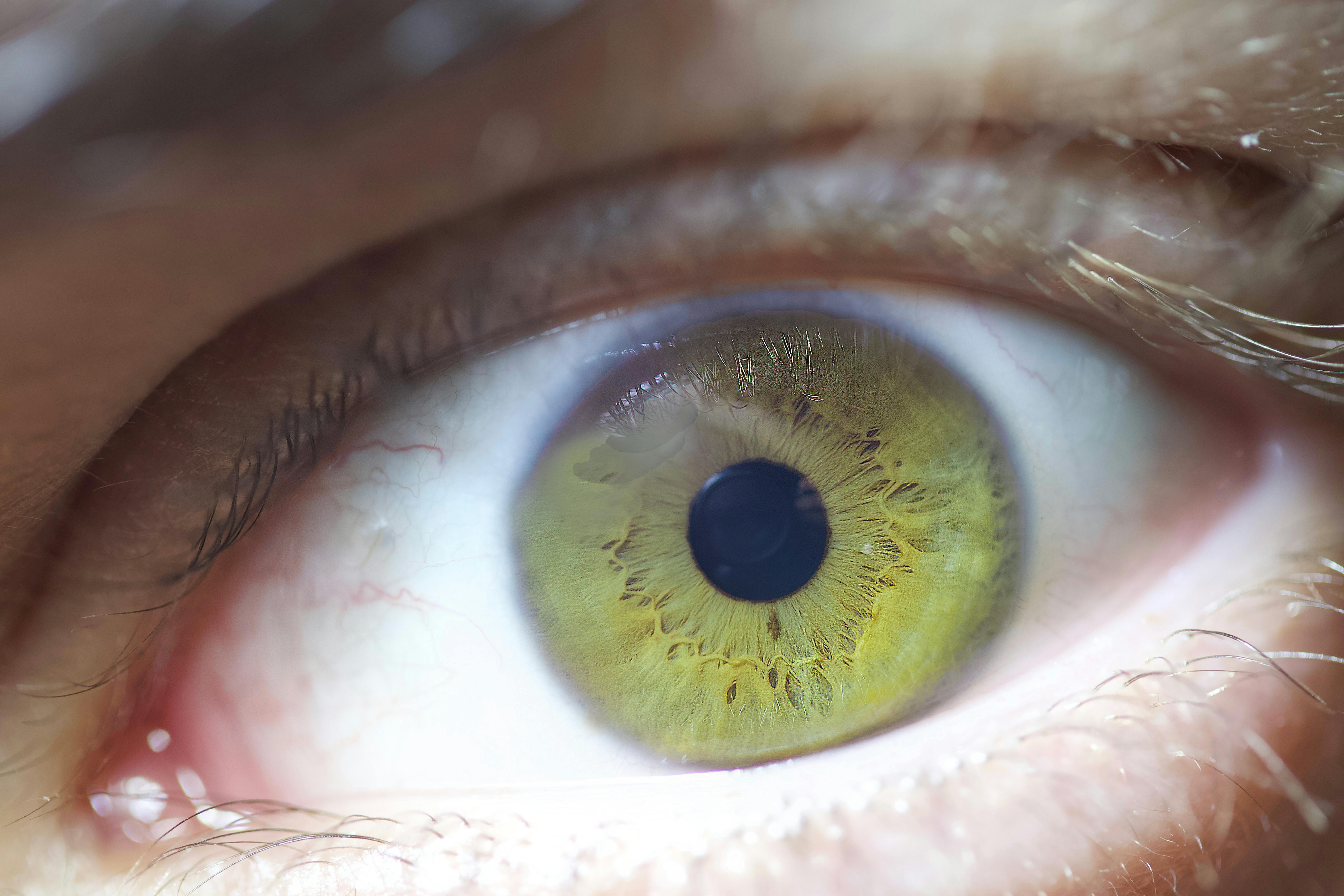 Bacteriile și infecțiile pot juca un rol semnificativ în degradarea creierului odată cu înaintarea în vârstă. foto: pexels.com