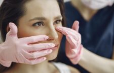 Cum să te pregătești și să te recuperezi corect după rinoplastie