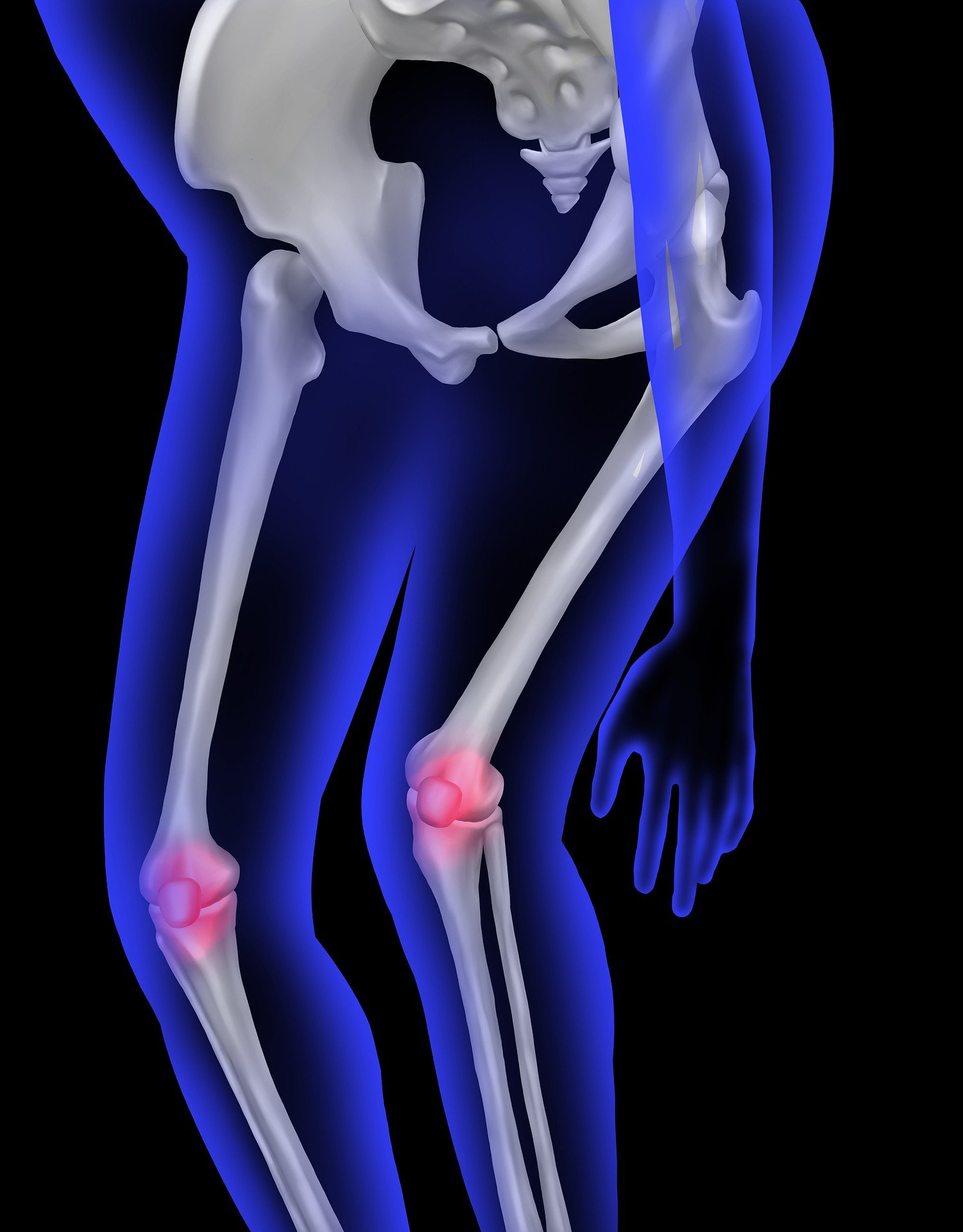 Pierderea rapidă în greutate provocată de aceste medicamente ar putea pune presiune suplimentară asupra sistemului musculo-scheletic. foto: pixabay.com