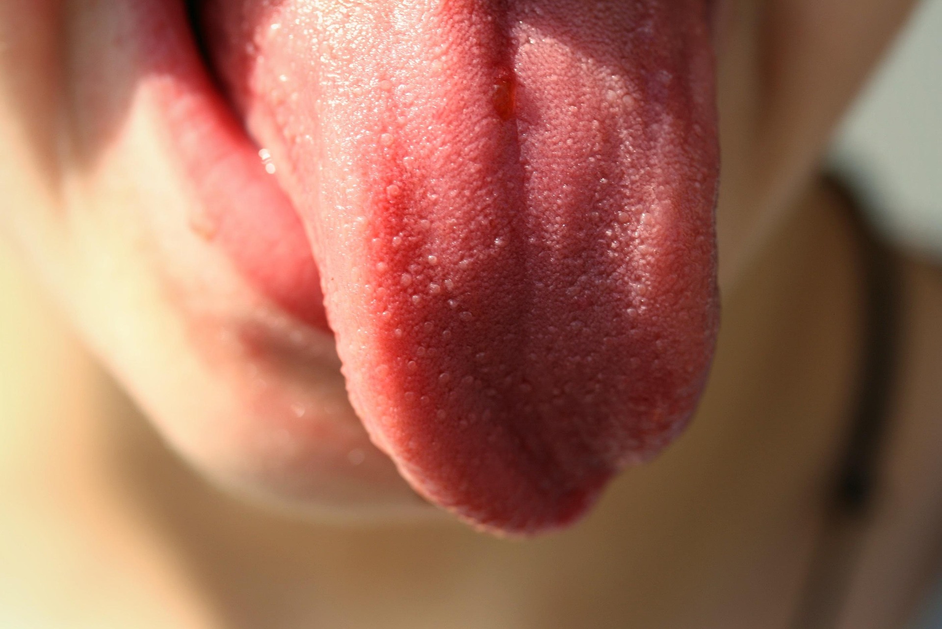 Deficitul de vitamina B12 afectează aproximativ 6% dintre persoanele sub 60 de ani și până la 20% dintre cele peste 60 de ani. foto: pixabay.com