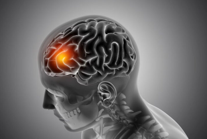 Neurologii susțin că acest nutrient este esențial pentru sănătatea creierului, dar majoritatea adulților nu-l primesc suficient