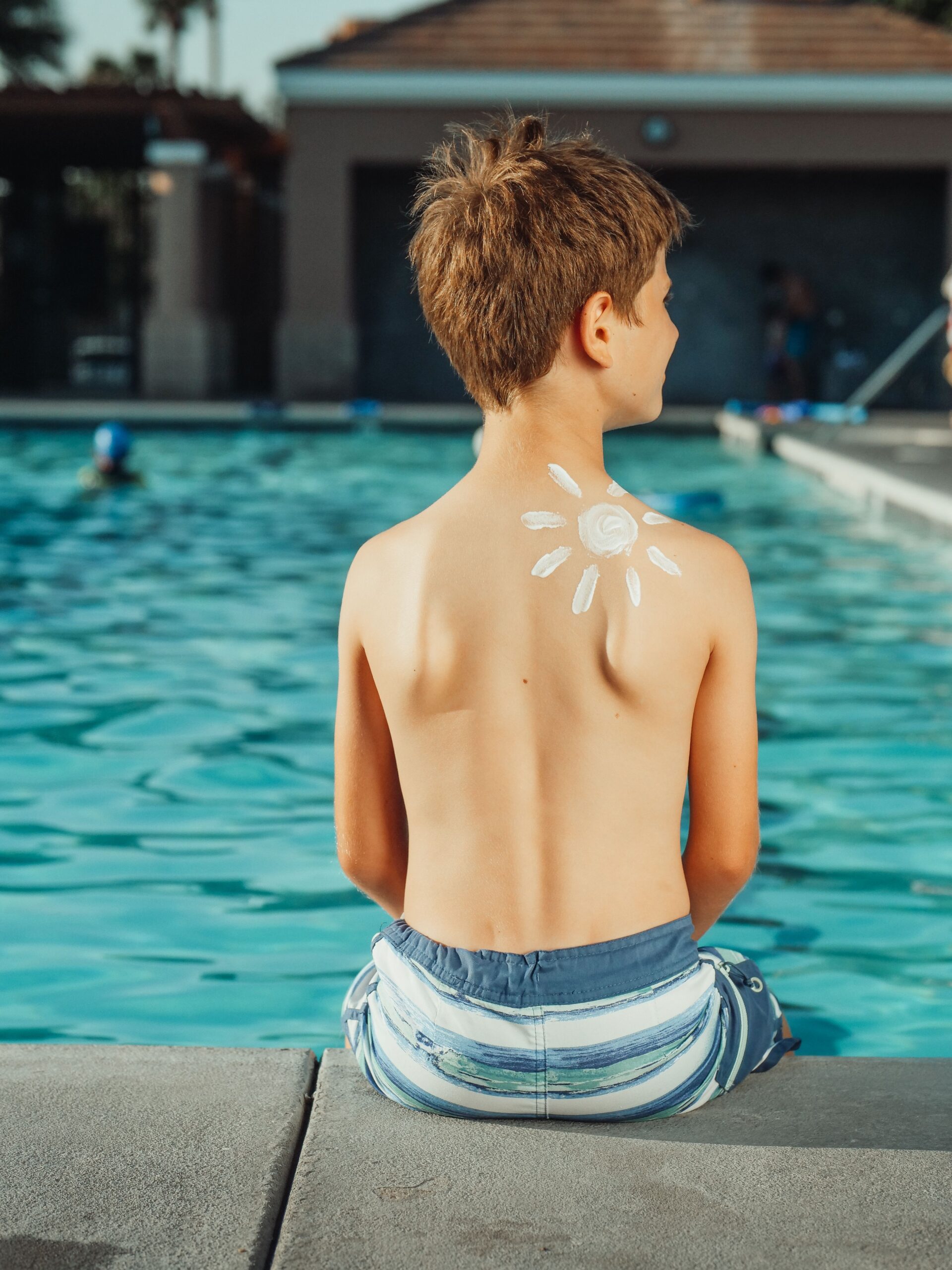 O singură arsură solară severă în copilărie sau adolescență poate dubla riscul de melanom, cea mai agresivă formă de cancer de piele. Foto: pexels.com