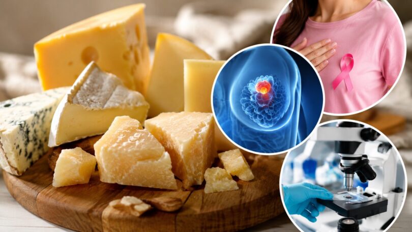 Consumul anumitor brânzeturi ar putea fi asociat cu un risc mai mare de cancer mamar. Ce spun, de fapt, cercetările