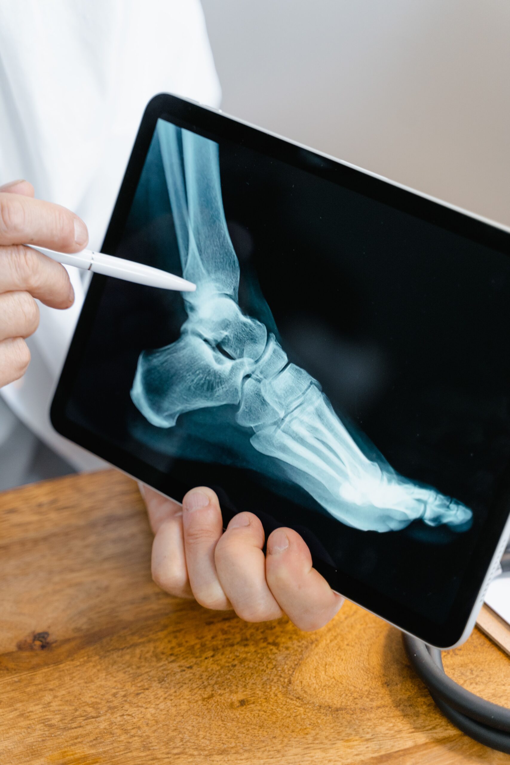 Prevenirea căderilor devine, de asemenea, extrem de importantă odată cu înaintarea în vârstă. Foto: pexels.com