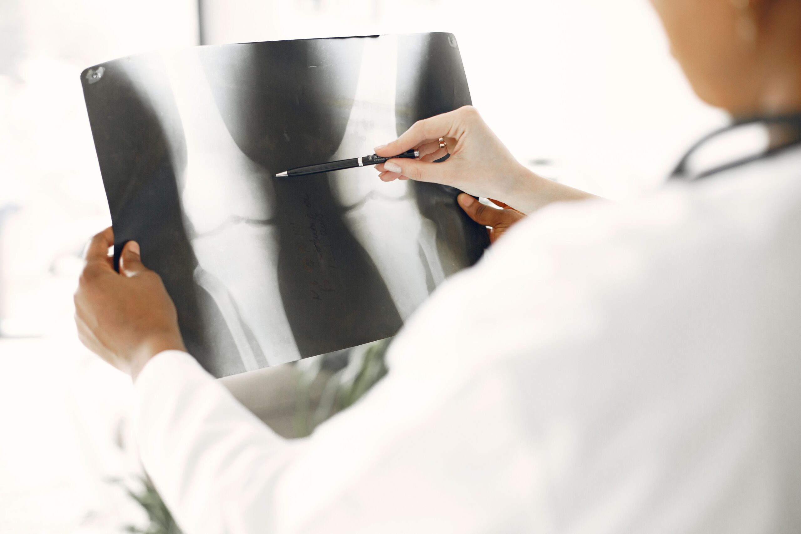 Scăderea nivelului de estrogen după menopauză crește riscul de pierdere a densității osoase. Foto: pexels.com