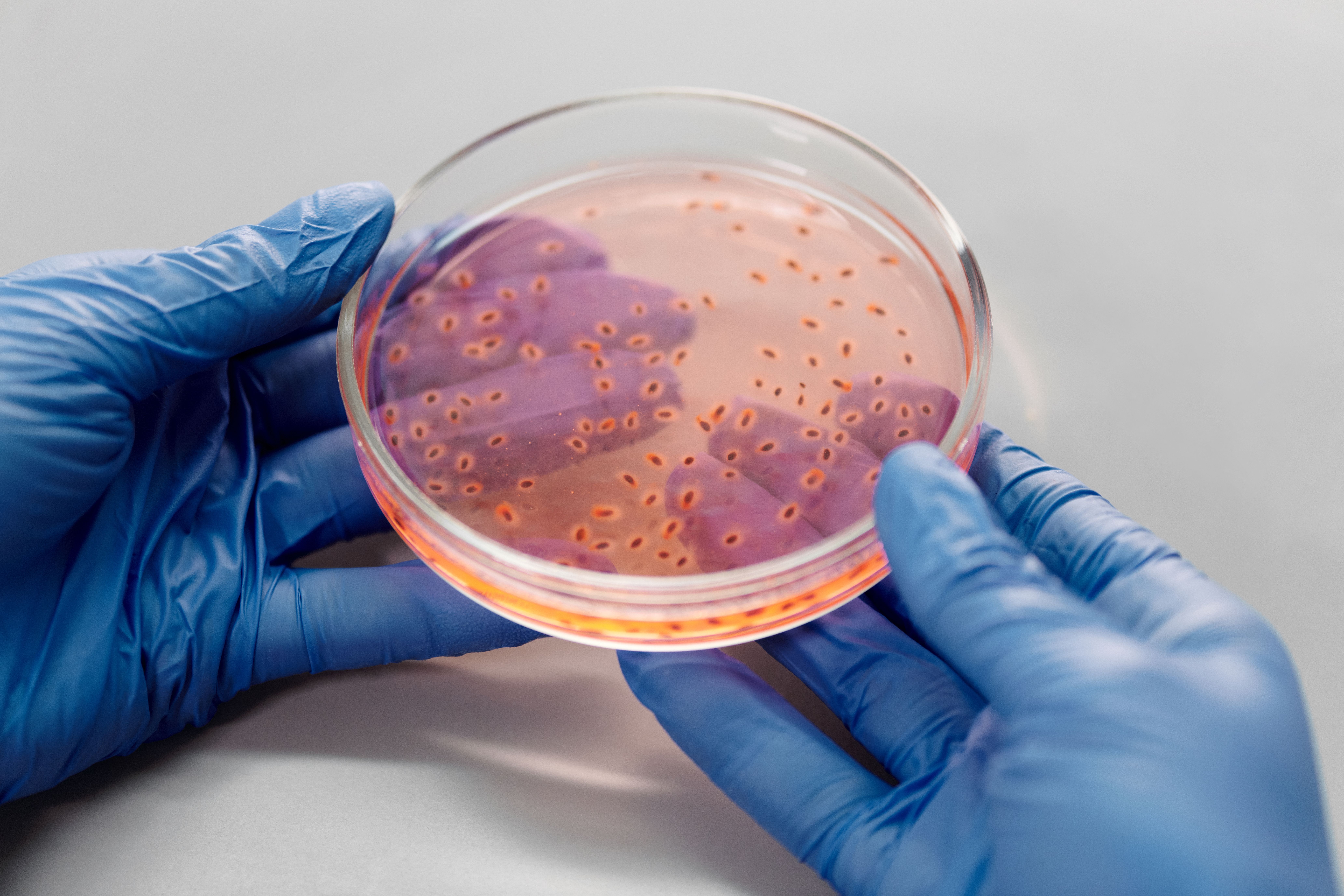 Potrivit autorităților sanitare, aproximativ una din cinci infecții cu Vibrio vulnificus este fatală. Foto: pexels.com