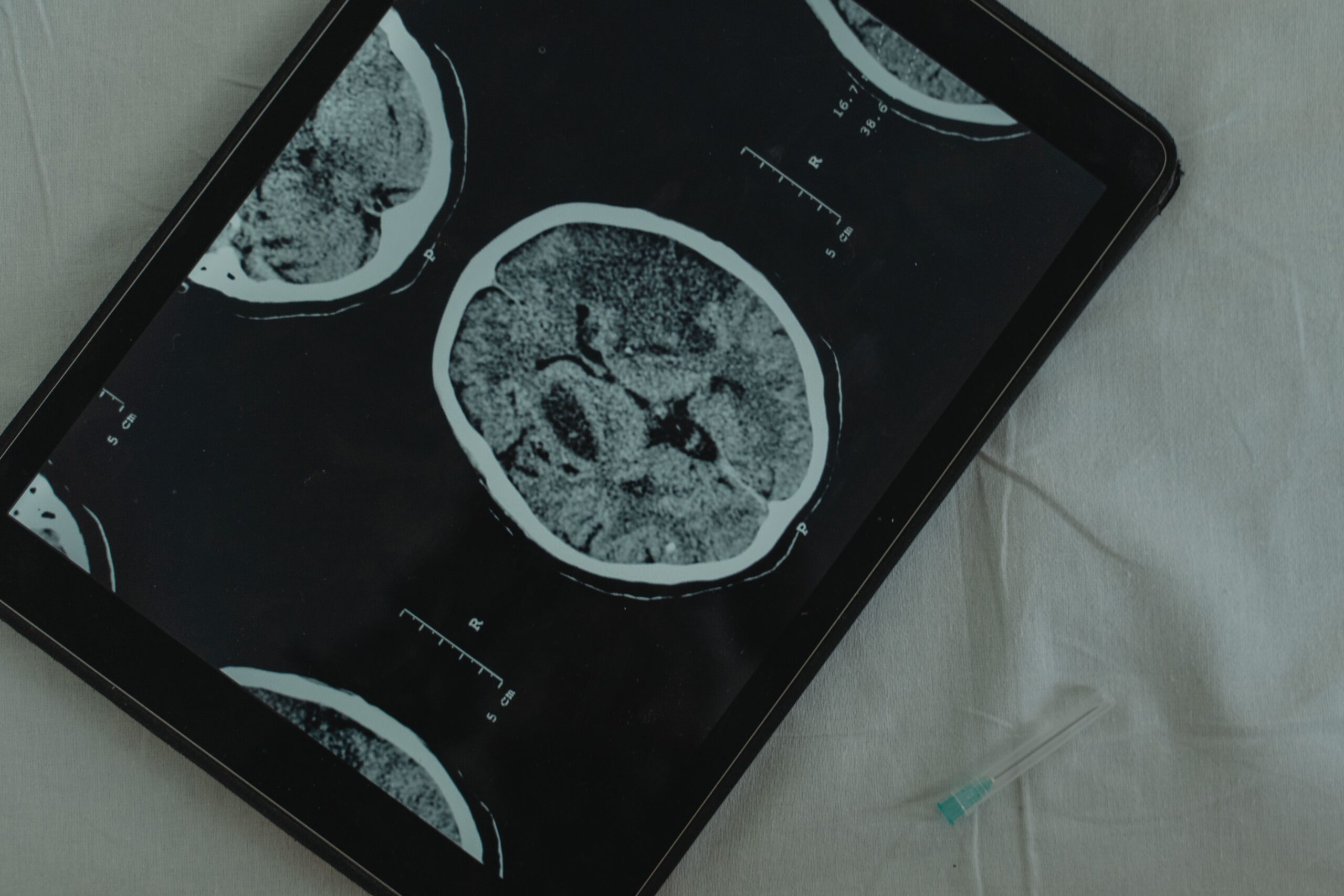 Sunt cele mai vechi organoide cerebrale crescute în laborator despre care există date. Foto: pexels.com
