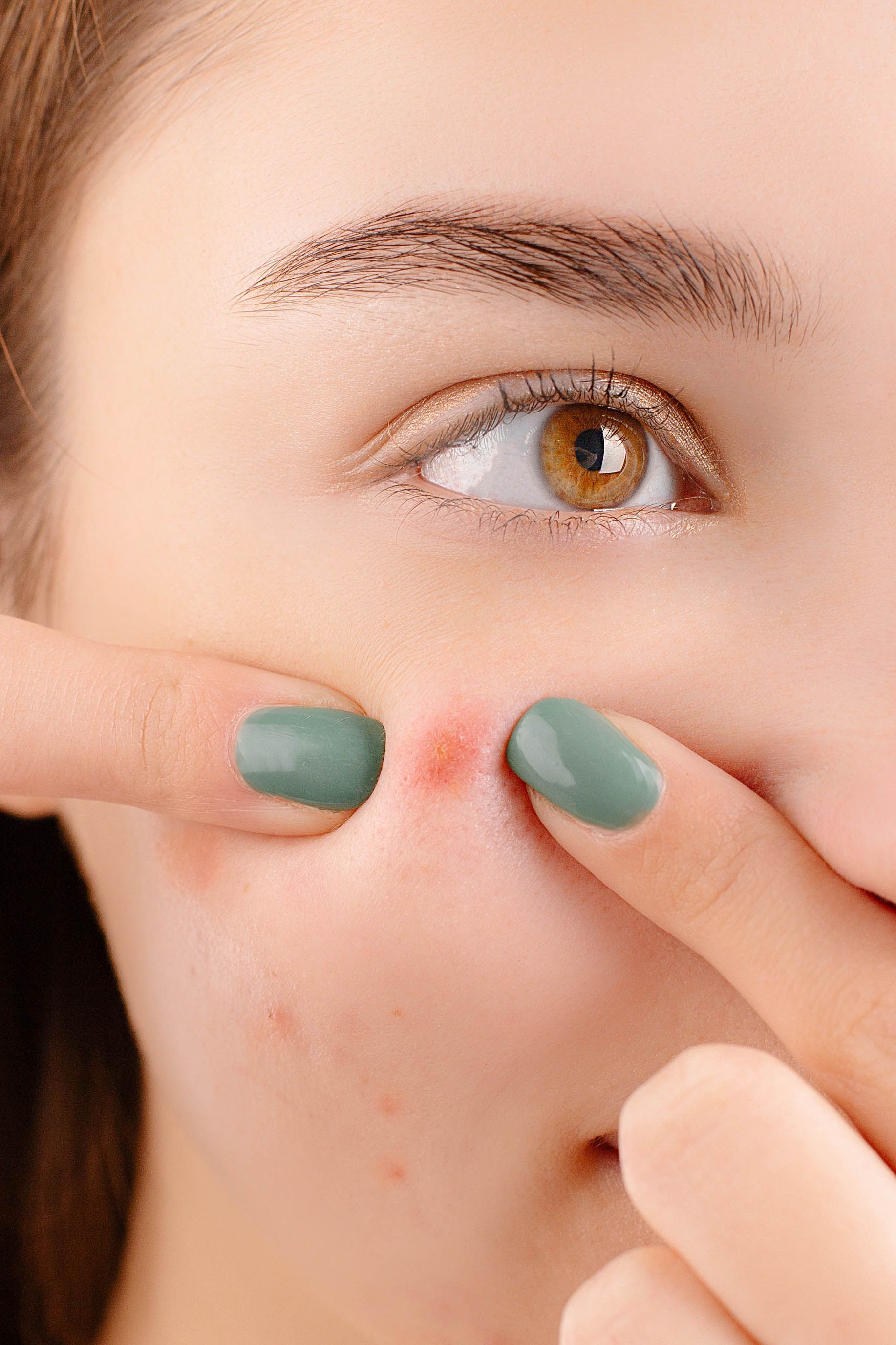 Persoanele care se confruntă în mod repetat cu astfel de infecții ar trebui să discute cu un dermatolog. Foto: pexels.com